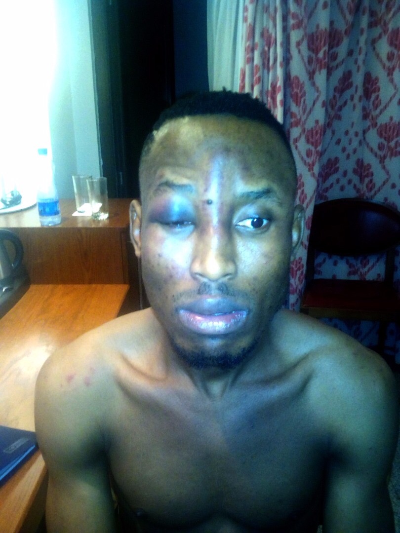 Photo of MR 2KAY REPORTEDLY ROBBED AFTER PERFORMANING AT “BUCKWYLD N BREATHLESS”