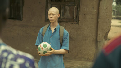 Photo of KÀSÉKÓ: A Moving Tale Of Love And Identity On International Albinism Awareness Day